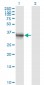 AKR1B10 Antibody (monoclonal) (M01)